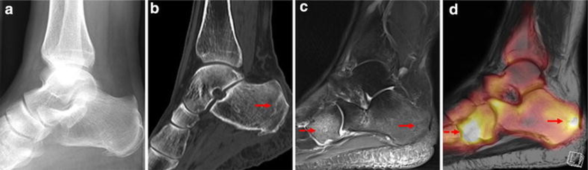 Medical scans